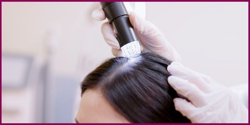 Queda de Cabelo: Causas, Tratamentos e Como Prevenir